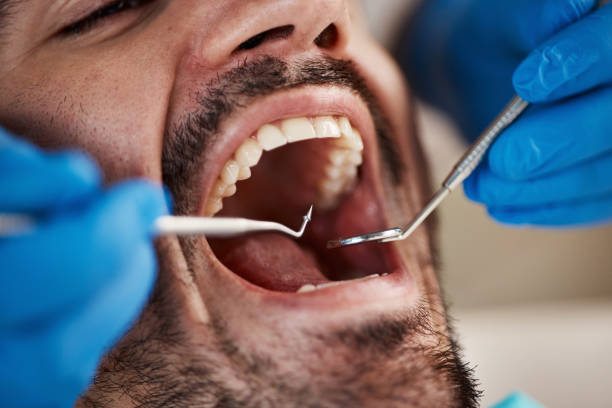 Best Teeth Whitening  in New Orleans Station, LA