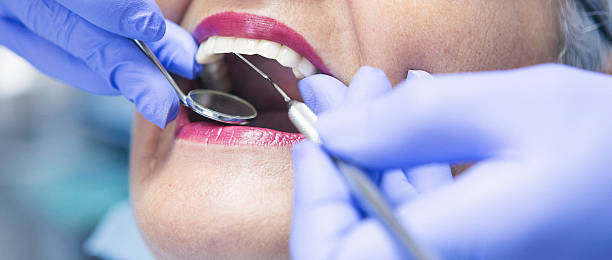 Best Chipped Tooth Repair Near Me  in New Orleans Station, LA