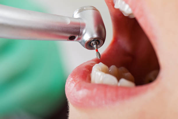 Best Tooth Pain Emergency Relief  in New Orleans Station, LA
